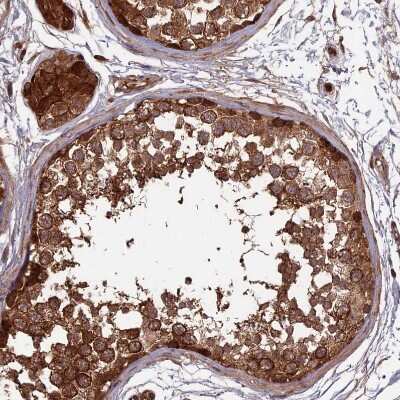 Immunohistochemistry-Paraffin: RCCD1 Antibody [NBP1-93518]