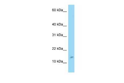 Western Blot: RCDG1 Antibody [NBP2-85614]