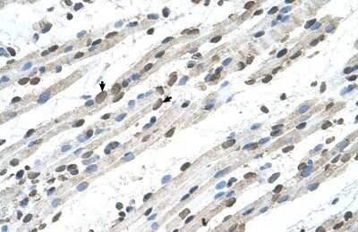 Immunohistochemistry-Paraffin: RCE1 Antibody [NBP1-59922]