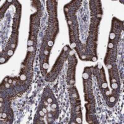 Immunohistochemistry-Paraffin: RCE1 Antibody [NBP3-17425]