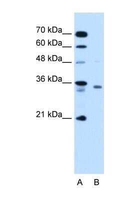 Western Blot: RCE1 Antibody [NBP1-59922]