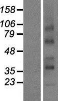 Western Blot: RCE1 Overexpression Lysate [NBP2-08606]