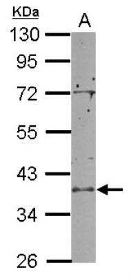 SDS-PAGE: RCL1 Antibody [NBP2-15096]