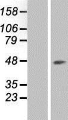 Western Blot: RCL1 Overexpression Lysate [NBP2-07701]