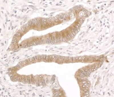 Immunohistochemistry-Paraffin: RCN1 Antibody [NB500-256]