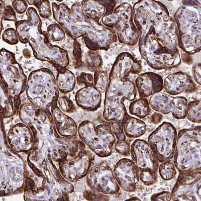 Immunohistochemistry: RCN1 Antibody [NBP2-37987]