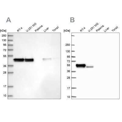 Western Blot: RCN1 Antibody [NBP1-83483]