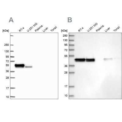 Western Blot: RCN1 Antibody [NBP2-37987]