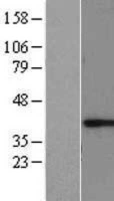 Western Blot: RCN1 Overexpression Lysate [NBL1-15246]