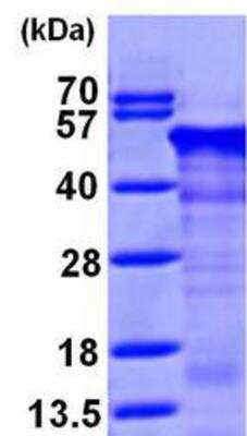 Western Blot: Recombinant Human RCN1 His Protein [NBP1-45321]