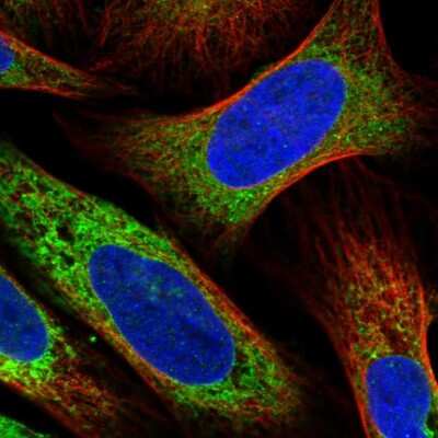 Immunocytochemistry/ Immunofluorescence: RCN2 Antibody [NBP2-32011]