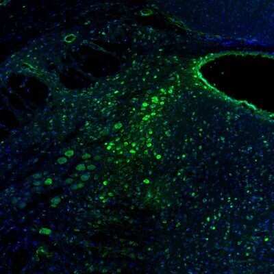 Immunohistochemistry: RCN2 Antibody [NBP2-32010]