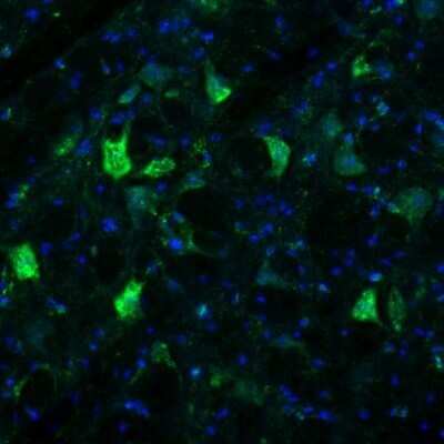 Immunohistochemistry: RCN2 Antibody [NBP2-32010]