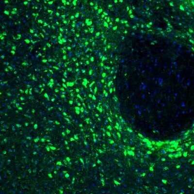 Immunohistochemistry: RCN2 Antibody [NBP2-32010]