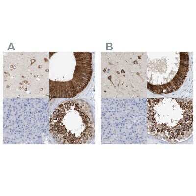 Immunohistochemistry-Paraffin: RCN2 Antibody [NBP2-32010]