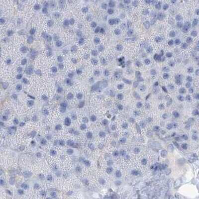 Immunohistochemistry-Paraffin: RCN2 Antibody [NBP2-32010]