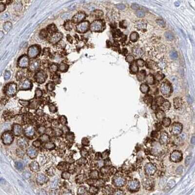 Immunohistochemistry-Paraffin: RCN2 Antibody [NBP2-32010]