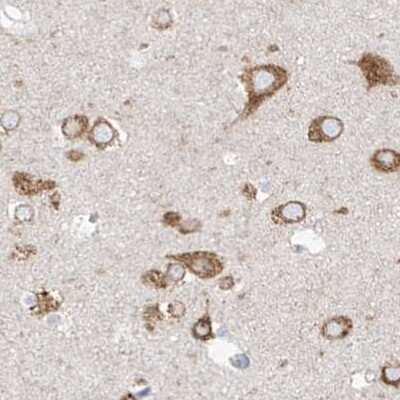 Immunohistochemistry-Paraffin: RCN2 Antibody [NBP2-32010]