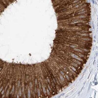 Immunohistochemistry-Paraffin: RCN2 Antibody [NBP2-32010]