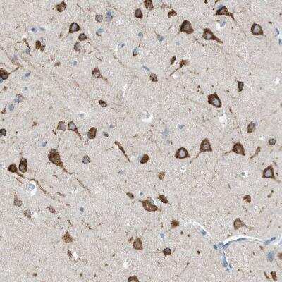 Immunohistochemistry-Paraffin: RCN2 Antibody [NBP2-32011]