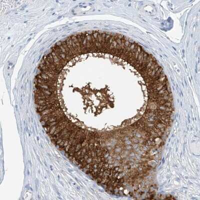 Immunohistochemistry-Paraffin: RCN2 Antibody [NBP2-32011]