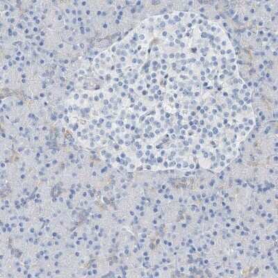 Immunohistochemistry-Paraffin: RCN2 Antibody [NBP2-32011]