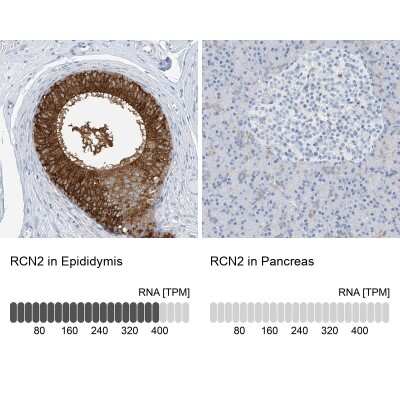 Immunohistochemistry-Paraffin: RCN2 Antibody [NBP2-32011]