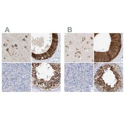 Immunohistochemistry-Paraffin: RCN2 Antibody [NBP2-32011]