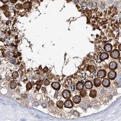 Immunohistochemistry-Paraffin: RCN2 Antibody [NBP2-32011]