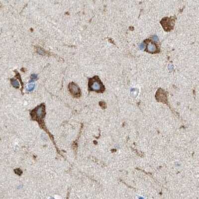 Immunohistochemistry-Paraffin: RCN2 Antibody [NBP2-32011]