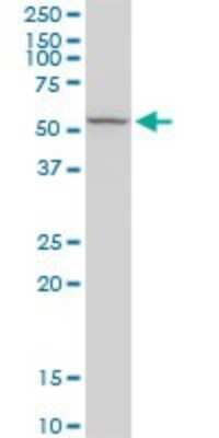 Western Blot: RCN2 Antibody [H00005955-D01P]