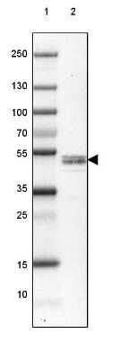 Western Blot: RCN2 Antibody [NBP2-32010]