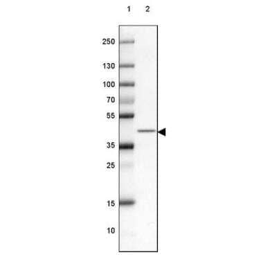 Western Blot: RCN2 Antibody [NBP2-32011]