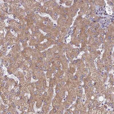 Immunohistochemistry-Paraffin: RCN3 Antibody [NBP2-13213]