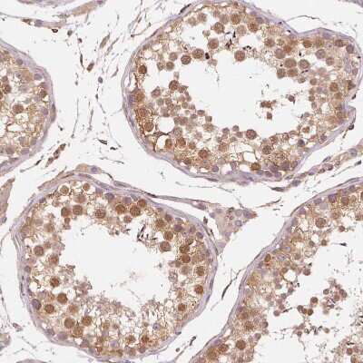 Immunohistochemistry-Paraffin: RCN3 Antibody [NBP2-38627]
