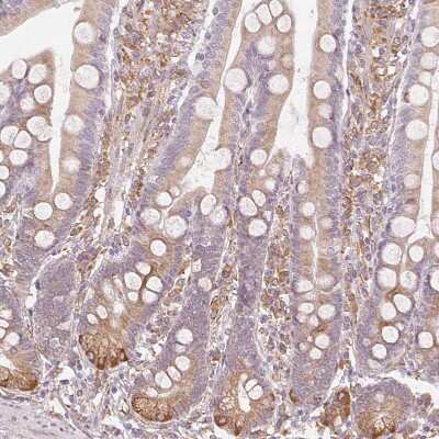 Immunohistochemistry-Paraffin: RCN3 Antibody [NBP2-38627]