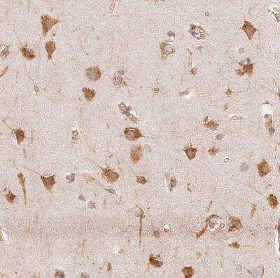 Immunohistochemistry-Paraffin: RCN3 Antibody [NBP2-38627]