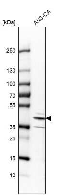 Western Blot: RCN3 Antibody [NBP2-38627]