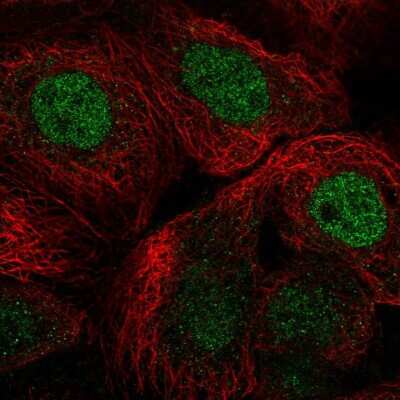 Immunocytochemistry/ Immunofluorescence: RCOR1/CoREST Antibody [NBP2-38720]