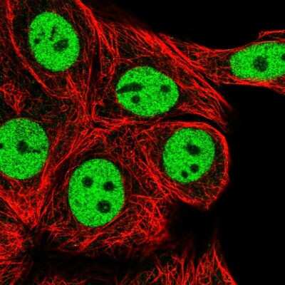 Immunocytochemistry/ Immunofluorescence: RCOR1/CoREST Antibody [NBP2-58094]