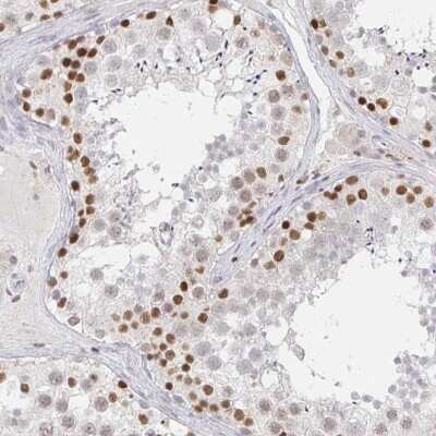 Immunohistochemistry-Paraffin: RCOR1/CoREST Antibody [NBP2-38720]