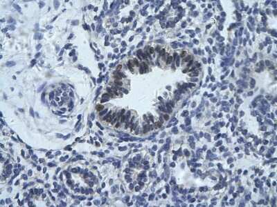 Immunohistochemistry-Paraffin: RCOR1/CoREST Antibody [NBP3-10324]