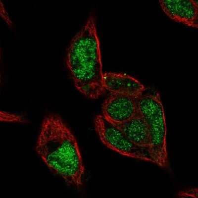 Immunocytochemistry/ Immunofluorescence: RCOR2 Antibody [NBP1-92323]