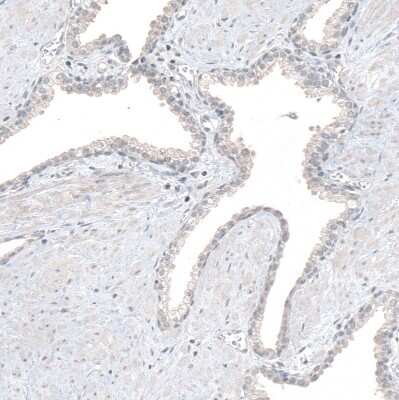 Immunohistochemistry-Paraffin: RCOR2 Antibody [NBP1-92323]