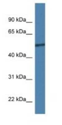 Western Blot: RCOR2 Antibody [NBP1-74099]