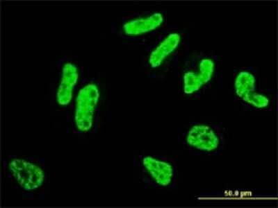 Immunocytochemistry/ Immunofluorescence: RCSD 1 Antibody (3F6) [H00092241-M01]