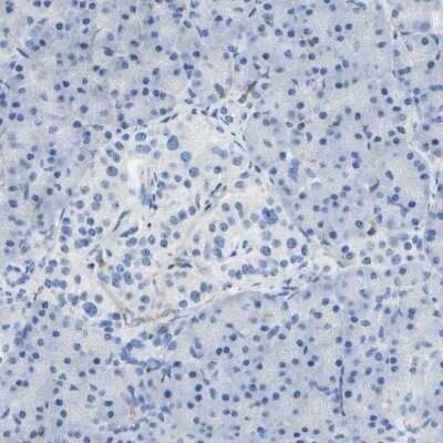 Immunohistochemistry-Paraffin: RCSD 1 Antibody [NBP2-13214]