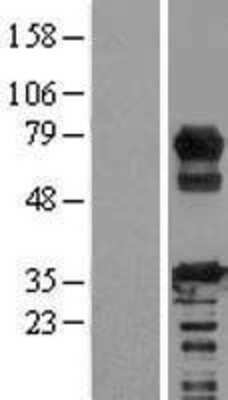 Western Blot: RCSD 1 Overexpression Lysate [NBP2-05856]