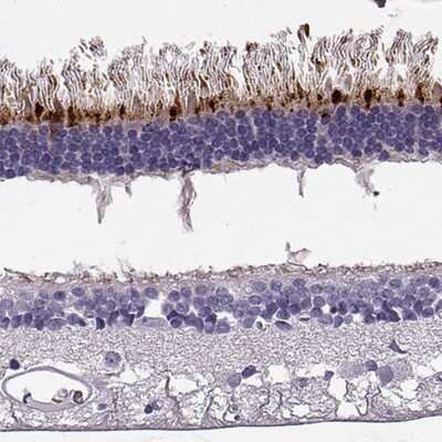 Immunohistochemistry-Paraffin: RD3 Antibody [NBP2-68611]