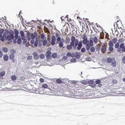 Immunohistochemistry-Paraffin: RD3 Antibody [NBP2-68612]